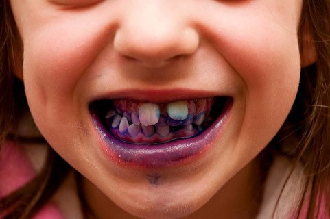 Child using disclosing tablets to show plaque on teeth