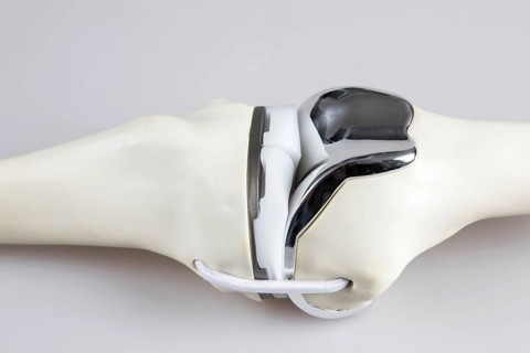 Knee prosthesis