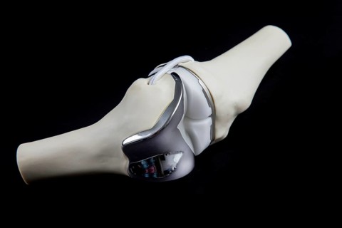 Knee prosthesis