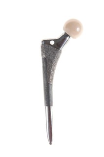 Endoprosthesis