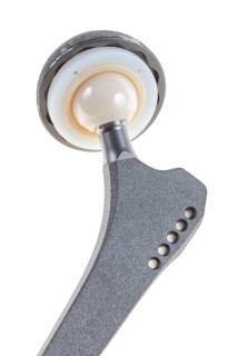 Endoprosthesis