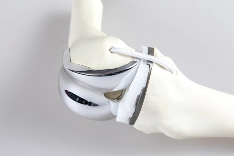 Knee prosthesis