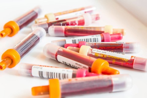 Blood samples