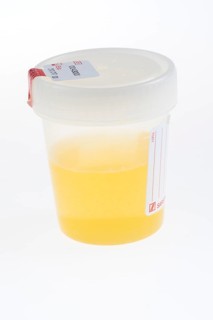 Sample beakers
