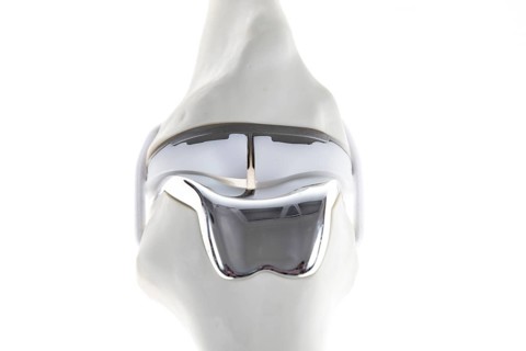 Knee prosthesis