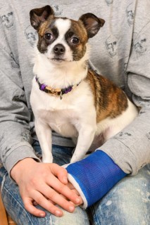 Small Chihuahua dog sitting on the lap of a girl with plaster bandage