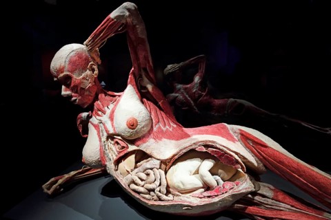 Plastinate