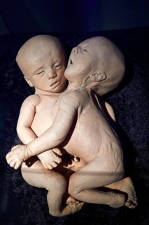 Plastinate