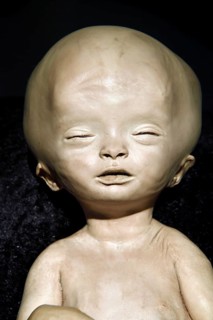 Plastinate