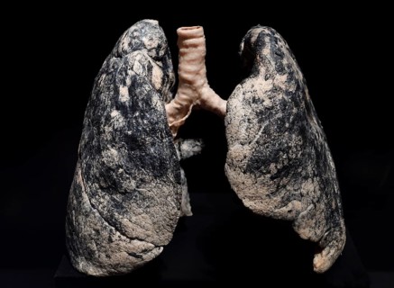 Plastinate