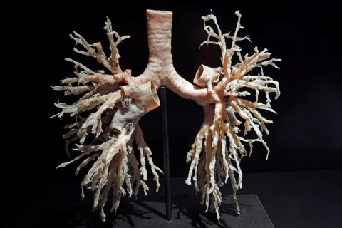 Plastinate