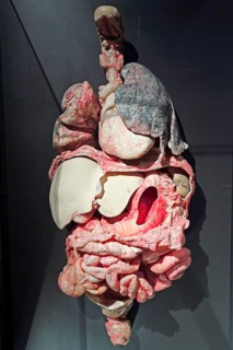 Plastinate