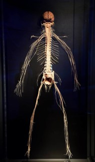 Plastinate