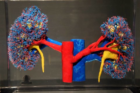 Plastinate