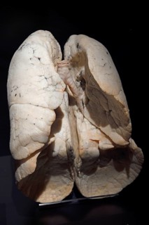 Plastinate