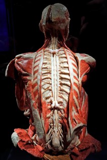 Plastinate