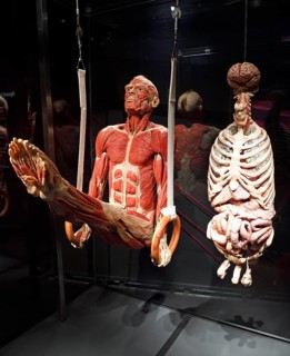 Plastinate
