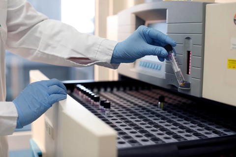 Laboratory testing for tuberculosis