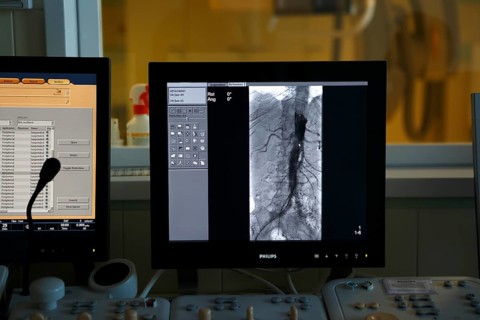 Interventional radiology