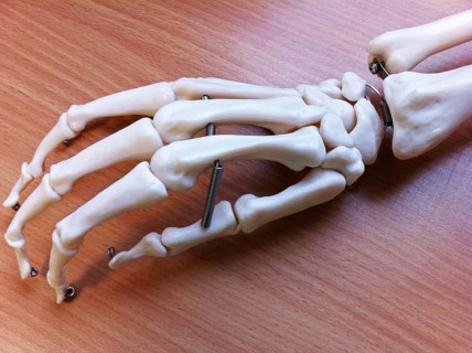 Artificial Hand