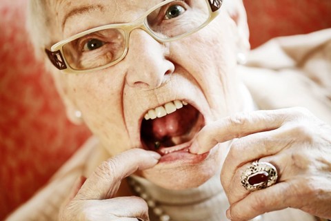 Senior suffering from dementia showing her mouth with missing teeth