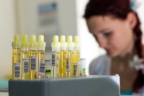Capillary tubes filled with yellow urine