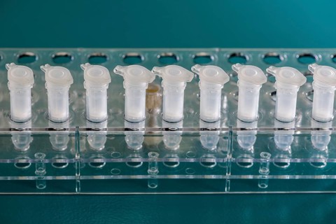 White Spin Filter sorted in a transparent rack