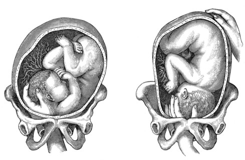 Parturition