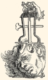 Skull surgery