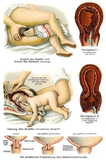 Obstetrics