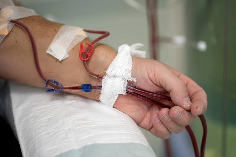 Patient during outpatient dialysis in the dialysis center of the Dominikus Krankenhaus hospital