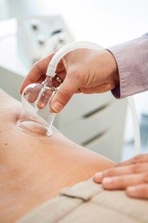 Cupping therapy