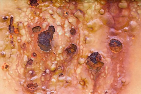 Rust stains