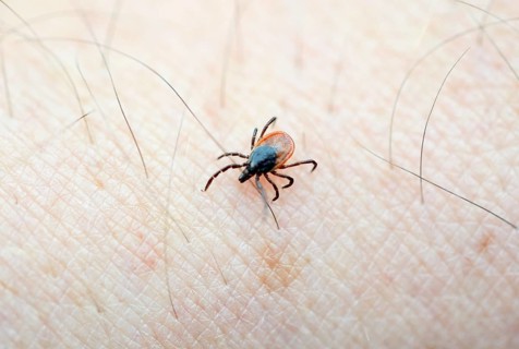 Castor Bean Tick (Ixodes ricinus) crawling on human skin