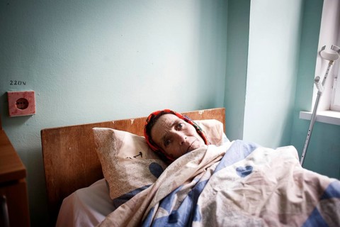 Tuberculosis and HIV in Moldova