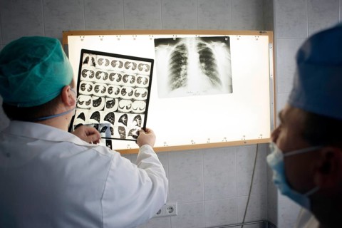 Tuberculosis in Moldova