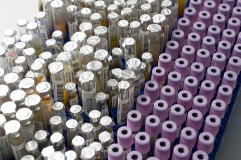 Test tubes with samples in a medical laboratory