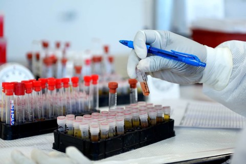 Lab technician with blood samples in a laboratory
