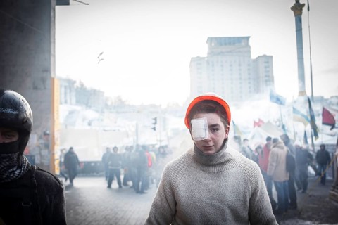 Injured protester