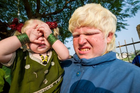 Two albinos covering and closing their sensitive eyes from the sunlight