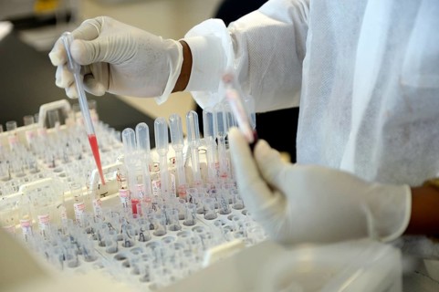 A lab technician is analysing blood samples in a laboratory