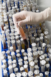 Test tubes with samples in a medical laboratory