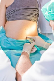 Pregnant women during delivery in the delivery room with an anesthesiologist applying a PDA or epidural