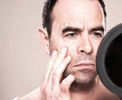 Man with markings for plastic surgery on his face