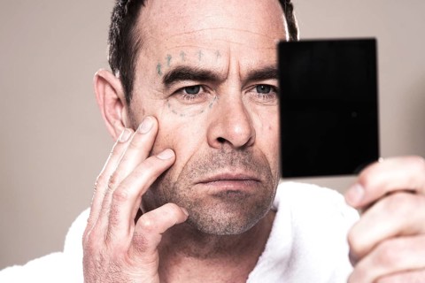 Man with markings for plastic surgery on his face