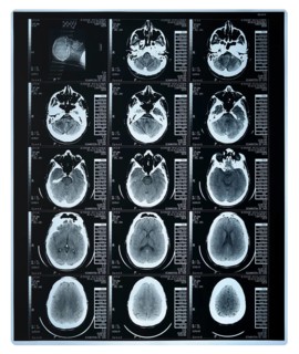 Scan of a human brain