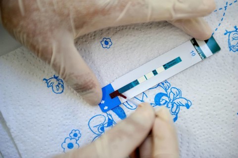 AIDS rapid test with a drop of blood that is taken from the fingertip