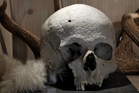 Skull