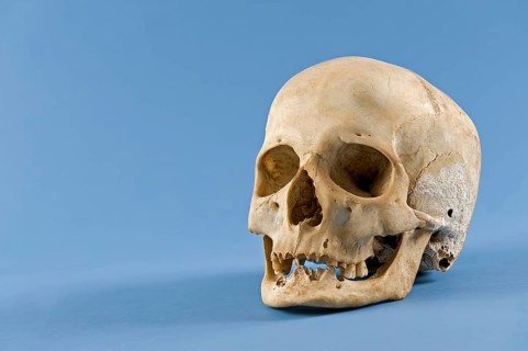Human skull