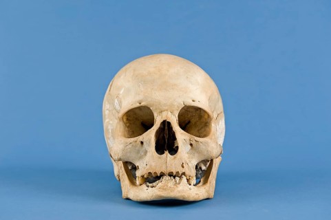 Human skull